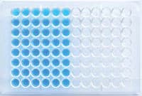 Gold Standard Diagnostics Schistosoma Mansoni IgG ELISA Test Kit - Schistosoma Mansoni IgG - Image 1