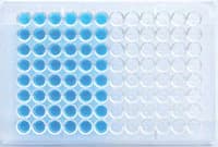 Gold Standard Diagnostics HSV 1 & 2 IgM ELISA Test Kit, 96 Tests - HSV 1 & 2 IgM - Image 1