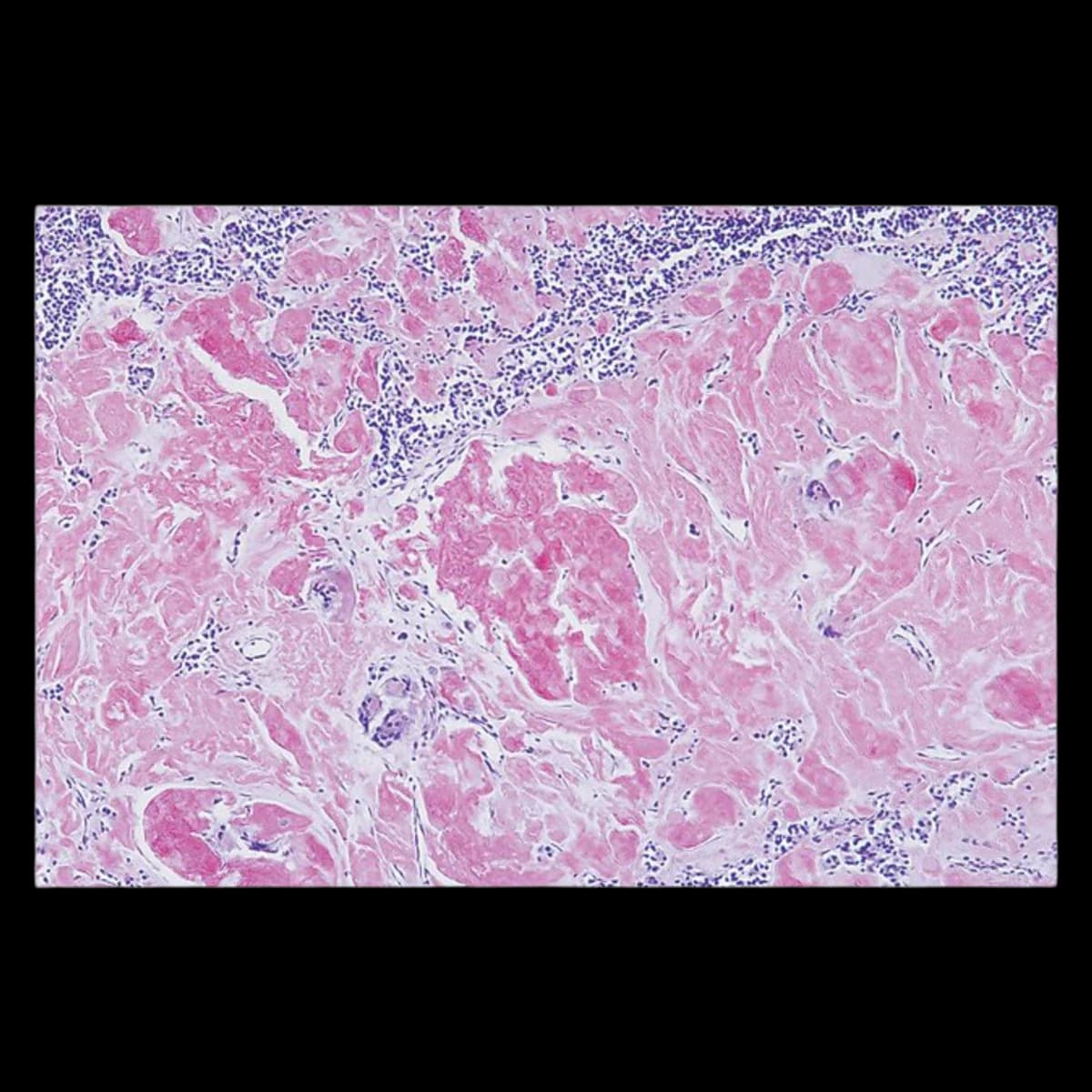 Richard-Allan Scientific Amyloid Stain Kit - Stain Kit Amyloid - Image 1