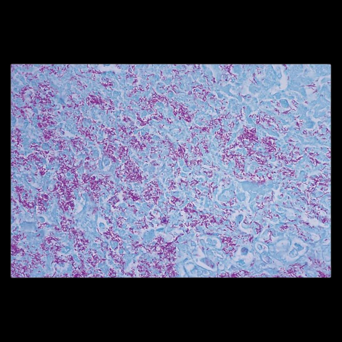 Richard-Allan Scientific Acid Fast Bacillus (AFB) Stain Kit, Green, Each - Stain Kit Acid Fast Bacillus - Image 1