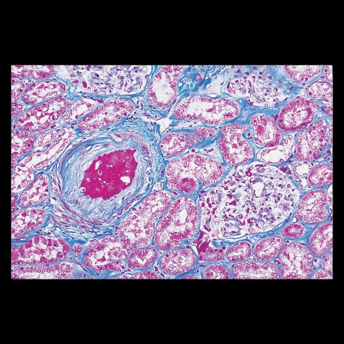 Stain Kit Masson Trichrome, Richard-Allan Scientific - Stain Kit Masson Trichrome - Image 1
