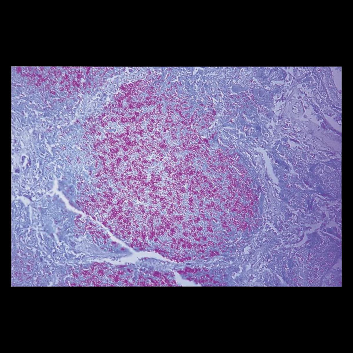 Richard-Allan Scientific Loeffler Methylene Blue Stain, 1 Each - Stain Loeffler Methylene - Image 1