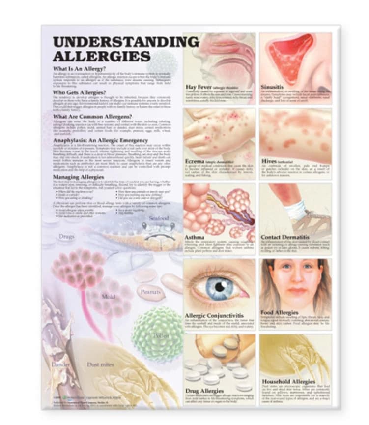Understanding Allergies Educational Chart, Laminated, 20" x 26", 2nd Edition - Chart Allergies Understand,Lam - Image 1