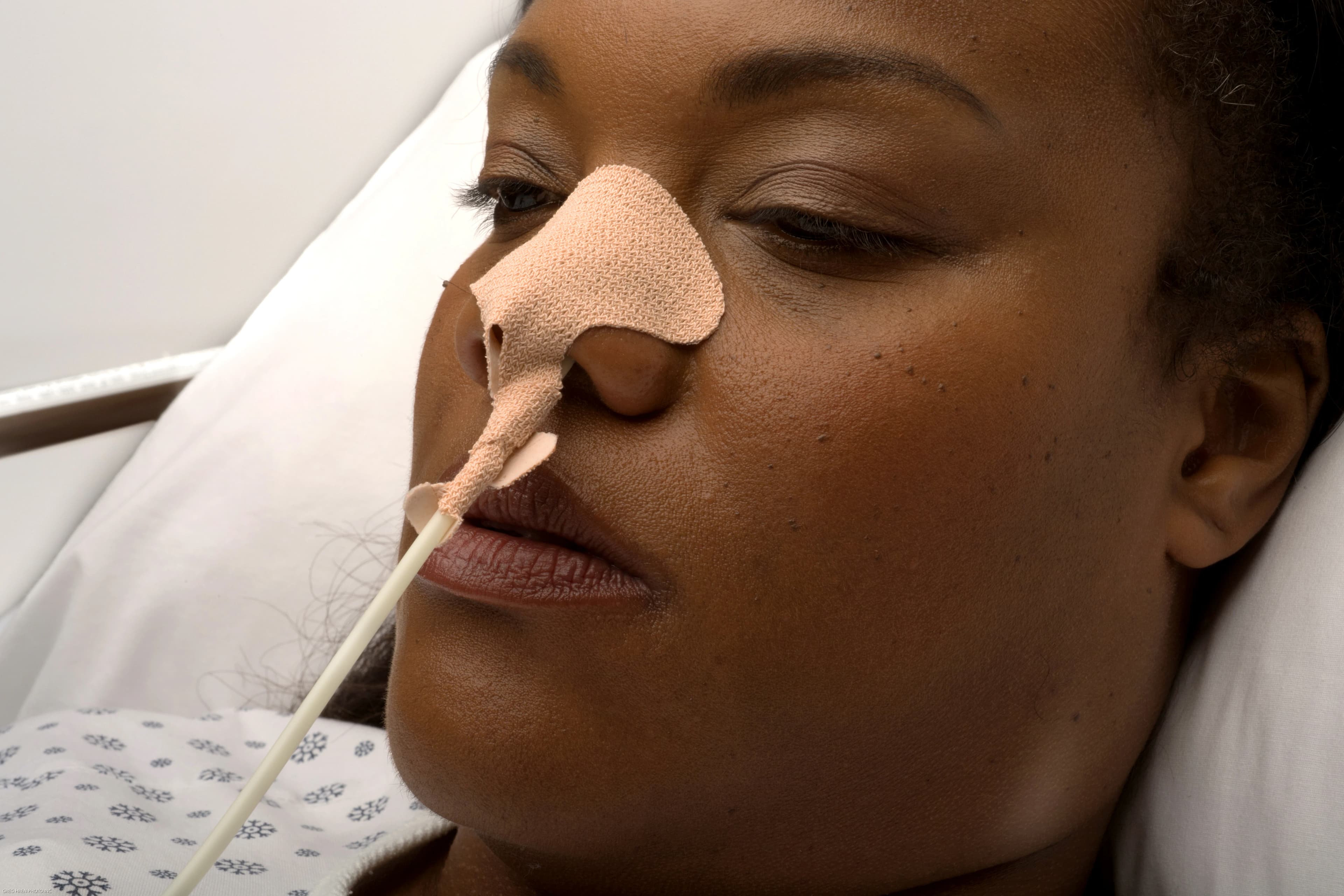 Dale Medical Nasogastric Tube Holder, 7/8" x 6" - Holder Nasogastric Tube - Image 1
