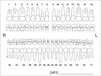 Label Tooth Chart Anatomy, 4 in x 3 in, 100/Package - Label Tooth Chart Anatomy - Image 1