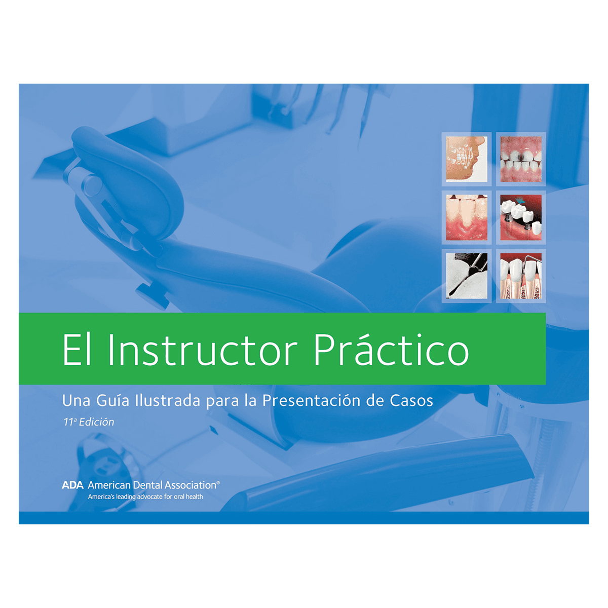 The Chairside Instructor: A Visual Guide to Case Presentations, Spanish Edition, 11th Edition (Spiral-Bound) - The Chairside Instructor A Visual Guide to Case Presentations Spanish 11th Edition - Image 1