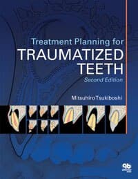 Treatment Planning for Traumatized Teeth, Second Edition (Softcover, 240 pp, ISBN 978-0-86715-511-2) - Treatment Planning for Traumatized Teeth Second Edition - Image 1