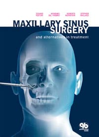 Maxillary Sinus Surgery and Alternatives in Treatment (Testori, Del Fabbro, Weinstein, Wallace), 380 pp, ISBN 978-1-85097-170-2 - Maxillary Sinus Surgery and Alternatives in Treatment - Image 1