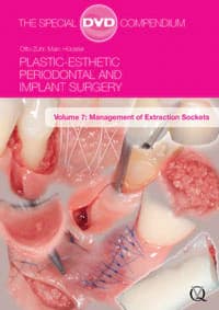 DVD Plastic-Esthetic Periodontal and Implant Surgery: Management of Extraction Sockets, Volume 7 (Quintessence Publishing) - DVD Plastic-Esthetic Perio Imp - Image 1
