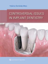 Controversial Issues in Implant Dentistry by Federico Hernandez Alfaro, 264 pp, ISBN 978-1-85097-234-1 - Controversial Issues in Implant Dentistry / Alfaro Federico Hernandez - Image 1