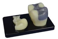 Model Onlay Display Stand, Plastic, 3 in x 5 in x 0.5 in, Each - Model Onlay Display Stand - Image 1
