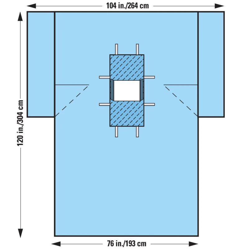 O&M Halyard Sterile Laparotomy/Cholecystectomy Drape, 104x76x120", Fenestrated 12x13" - Surg Lap Choly Drape - Image 1