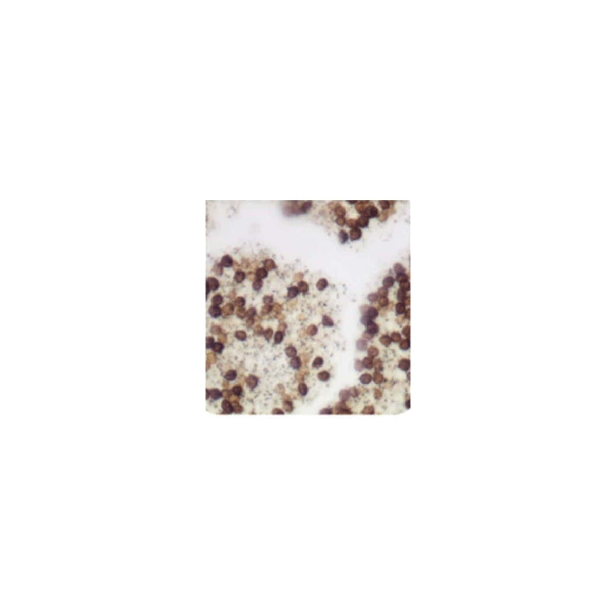 Azer Scientific Warthin-Starry Stain Kit thumbnail 3