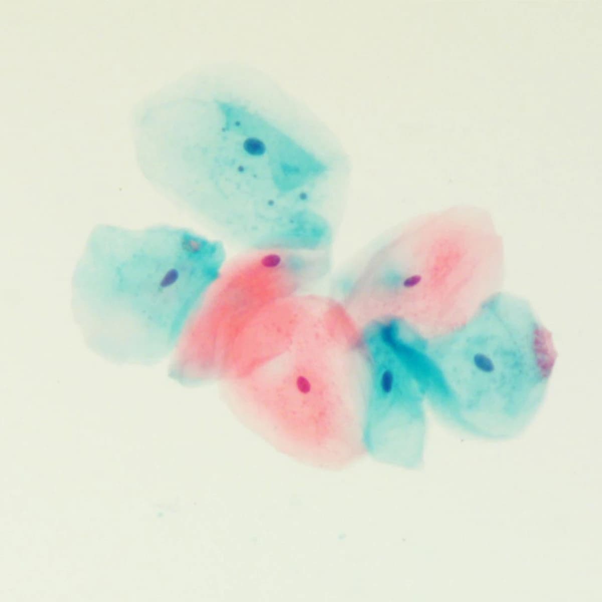 Azer Scientific EasyPap Cytology Stain, 1 Gallon, 4/Case - Easy Pap Stain - Image 1