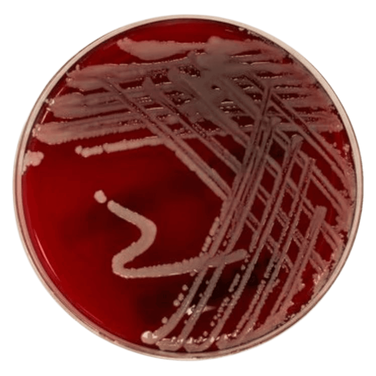 Remel Blood Agar (TSA with 5% Sheep Blood), Monoplate, 100/Pk - Blood Agar,5% Sheep - Image 1