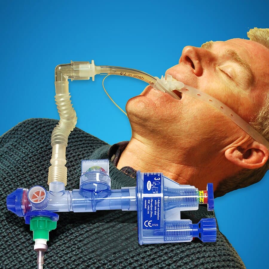 SureVent Emergency Oxygen Ventilator with Manometer and Flex Tube thumbnail 2