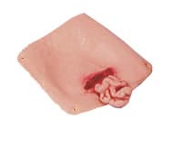 Nasco Healthcare Abdominal Wound Training Manikin (Each) - One Abdominal Wound - Image 1