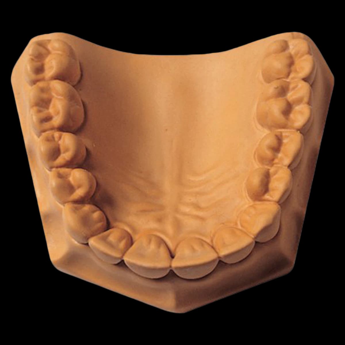 Whip Mix Microstone Golden Lab Stone, ISO Type 3, 33 lb (15 kg) Carton, #330054 - Microstone 33 lb. Carton - Image 1