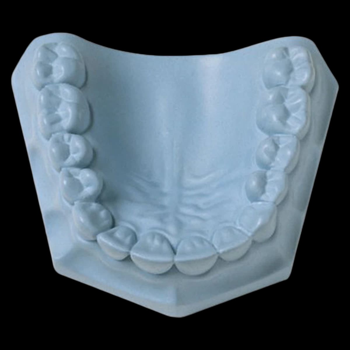 Whip Mix LeanRock Blue ISO Type 4 Die Stone, 33 lb/15 kg Carton, #330029 - LeanRock Blue 33lb/15kg - Image 1