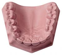 Whip Mix Snap-Stone Fast-Setting Type IV Dental Stone, Pink, 140g Envelopes, 80/Pack, #26514 - Snap-Stone Pre-weighed 140g Envelopes 80/Pack - Image 1