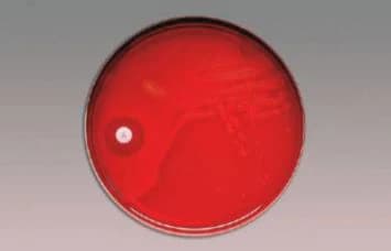BBL Taxo A Disc Vial, 6 Discs per Box - Taxo A-6 Vial BBL - Image 1