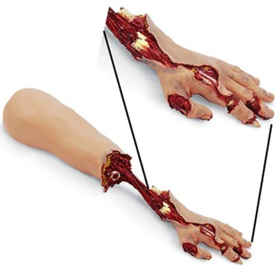 Nasco Healthcare Stat Basic Xtreme Trauma Arm - Stat Basic Xtreme Trauma Arm - Image 1