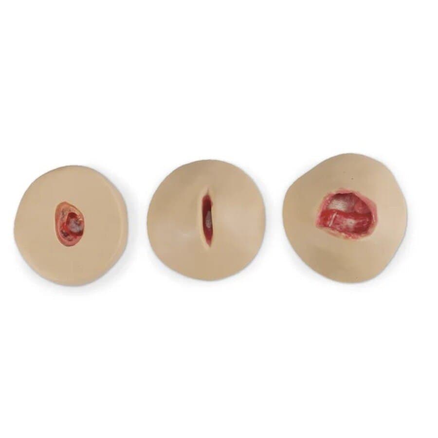 Nasco Negative Pressure Wound Therapy Trainer (Wound Care Simulation Model) - Negative Pressure Wound Therap - Image 1
