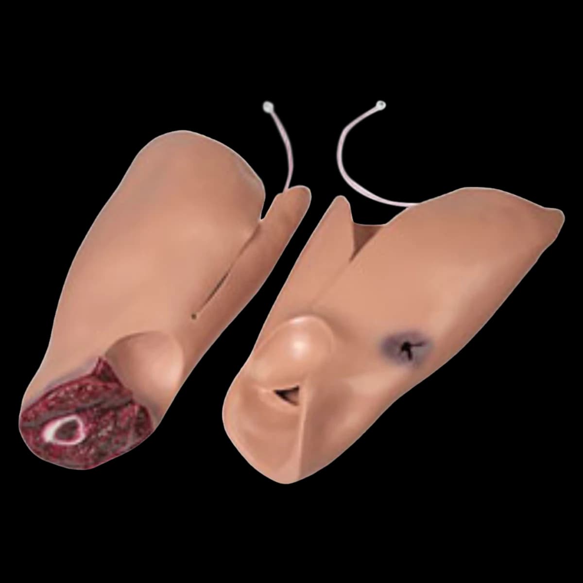 Nasco Healthcare Trauma Randy Leg Flash Moulage, Adult Leg Torso Overlay/Pumping System with Trauma Shorts, Femoral Artery, Tourniquet, High Trauma Packable Wound, Amputation Leg, 2/Package - Trauma Randy Leg Flash Moulage - Image 1