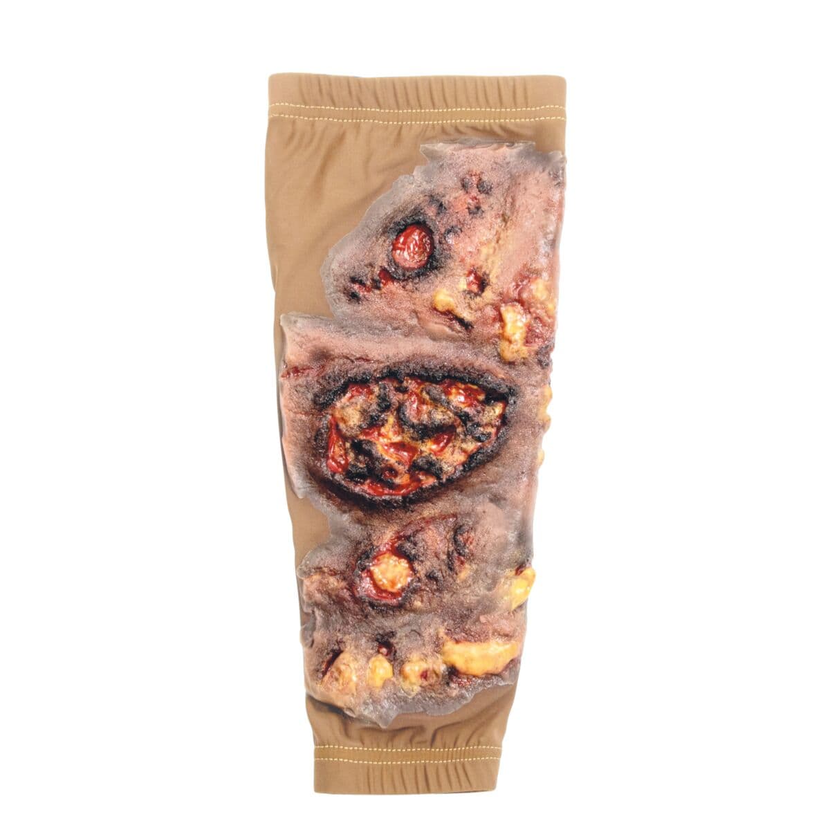 STOPS Medical Lower Leg Skin Burn Sleeve, Medium, Full Thickness, Each - Lower Leg Sleeve Burns - Image 1