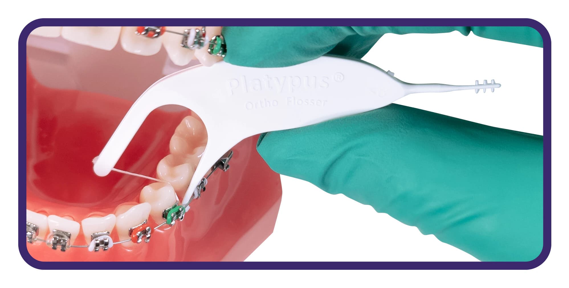 Platypus Orthodontic Flosser Patient Sampler, 75 Packs of 3, 225 Total, T103 thumbnail 3