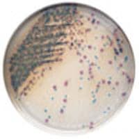 BBL CHROMagar Orientation Agar Culture Plates, 100/Pk - BBL Chromagar Plates - Image 1