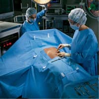 O & M Halyard Laparoscopic Cholecystectomy Procedure Kit - Laparoscopic Cholecystectomy - Image 1