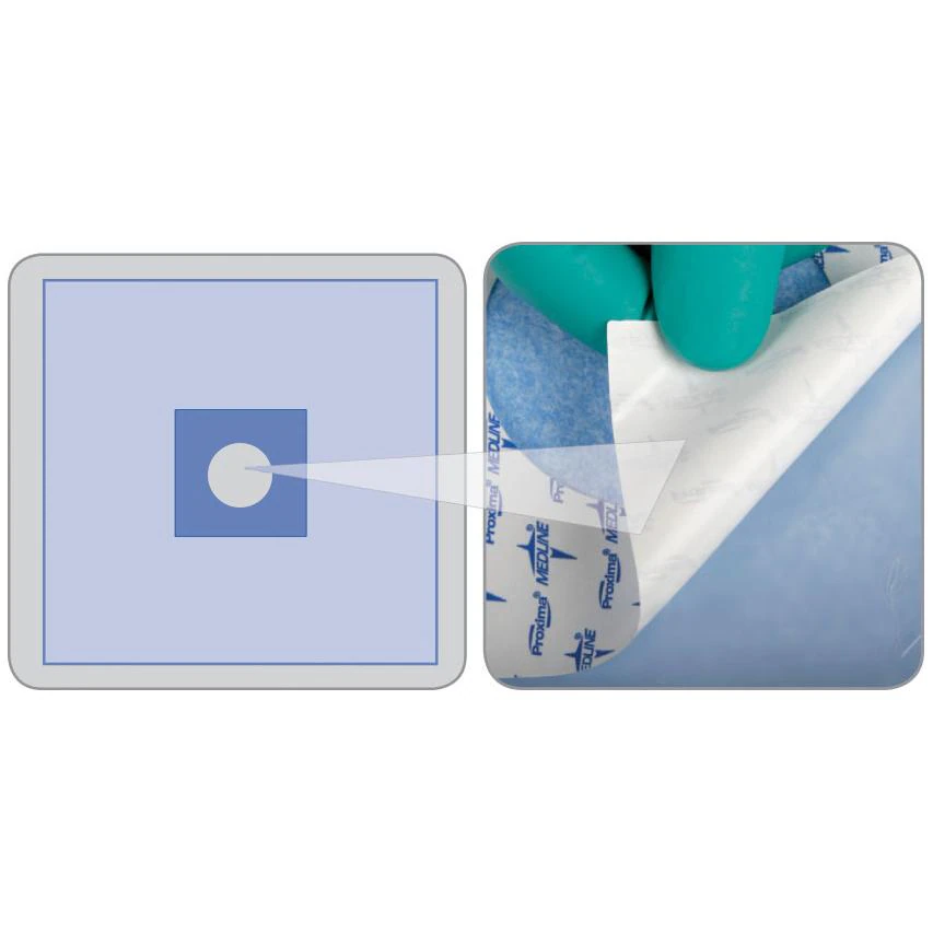 Medline InvisiShield Sterile Fenestrated Surgical Drape, 16x16" Aperture, 1/Each - Drape Aperture - Image 1