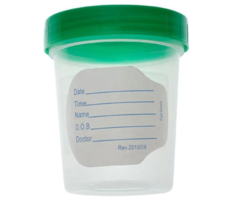 AMSure Sterile Specimen Container, 4 oz, Tamper-Evident Screw Cap, Green, 100/Case (17000) thumbnail 2