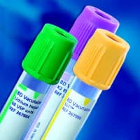 BD Vacutainer Plus Serum Tube, Red Silicone, 6mL, Hemogard Closure, Latex-Free, 1000/Case - VIT VACUTAINER SERUM TUBE - Image 1
