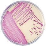 BD BBL CHROMagar MRSA II Culture Plate, 100/Package - 5W Bbl Chromagar Mrsaii 100 - Image 1