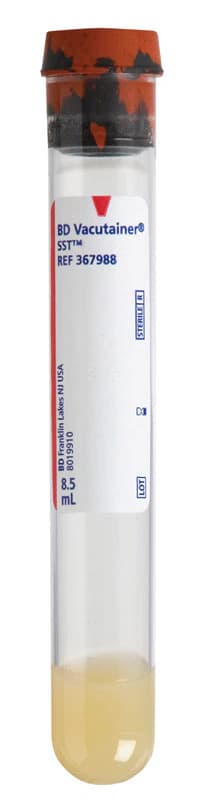 Vacutainer Plus SST Venous Blood Collection Tube, Red/Gray, 8.5mL, Plastic, Sterile, 100/Bx - Vacutainer Plus SST Venous Blood Collection Tube Red/Gray 8.5mL Plastic 100Bx - Image 1