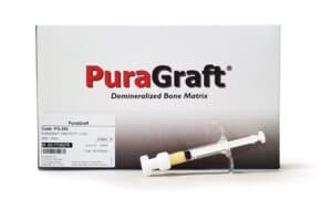 PuraGraft DBM Putty Syringe, 1.0cc, Demineralized Bone Matrix, 1/Pk, PG-100 thumbnail 3