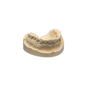 Whip Mix Microstone Golden Type III Dental Stone, 140 g Packets, 80/Box, 02364 thumbnail 7