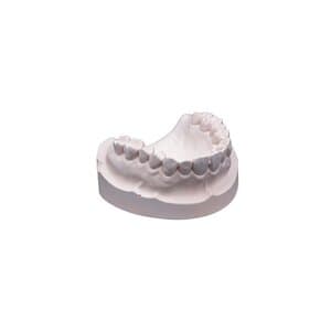 Whip Mix Snap-Stone Fast-Setting Type IV Dental Stone, Pink, 140g Envelopes, 80/Pack, #26514 thumbnail 7