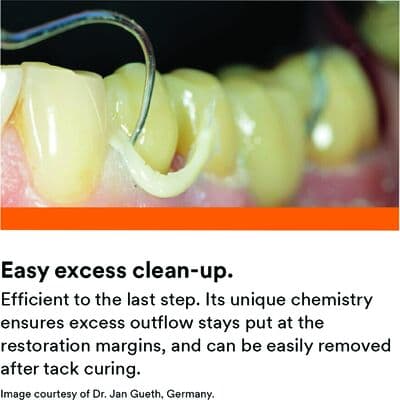 3M RelyX Universal Micro Mixing Tips, Orange, 30/Pkg, 56975 thumbnail 34