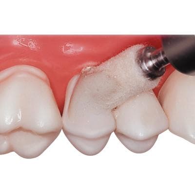Premier Dental Luminescence Intro Kit, Single-Step Diamond Polishing System, 3g Syringe, 2 RA Mandrels, 50 Applicators, #2014200 thumbnail 9