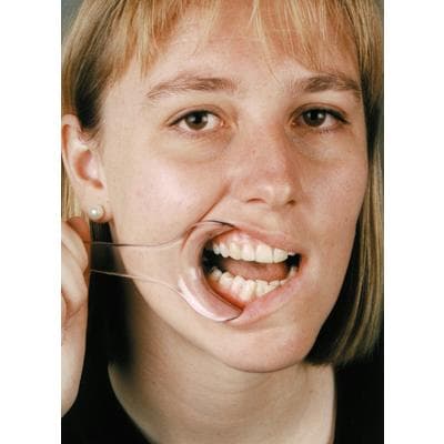 Mirahold Cheek Retractor, Adult, Single-Sided, Clear Plastic, 2/Pk, 605450 thumbnail 16