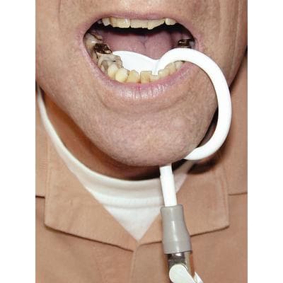 SweFlex Disposable Saliva Ejector Tips, Plastic, White, Anatomical Design, 100/Pk, 254150 thumbnail 15
