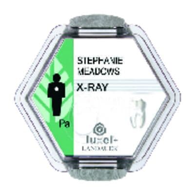 Radiation Detection Company X-Ray Monitoring Badge Service, Monthly Fetal Monitor Service Badge, 1/Pkg - X-Ray Monitoring Badge Service - Monthly Fetal Monitor Service Badge - Image 1