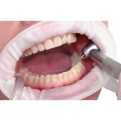OptraGate ExtraSoft Lip and Cheek Retractor Refill, Junior, 80/Pkg, 591451WW thumbnail 11