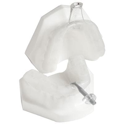 myTAP Precision-Fit Oral Appliance, Clear, Latex Free, Custom Fit, 1/Pkg - myTAP Precision-Fit Oral Appliance - myTAP Precision-Fit Oral Appliance - Image 1
