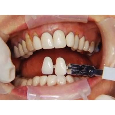 Dr. Christensen's Complex Oral Rehabilitation DVD - Dr. Christensen's Complex Oral Rehabilitation DVD - Dr. Christensen's Complex Oral Rehabilitation DVD - Image 1