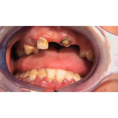 Dr. Christensen's Oral Surgery in General Practice DVD - Dr. Christensen's Oral Surgery in General Practice DVD - Dr. Christensen's Oral Surgery in General Practice DVD - Image 1