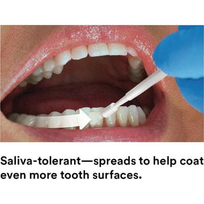 3M Vanish 5% Sodium Fluoride White Varnish with TCP, Mint, 0.5 mL Unit Dose, 100/Pk, 12150M thumbnail 26